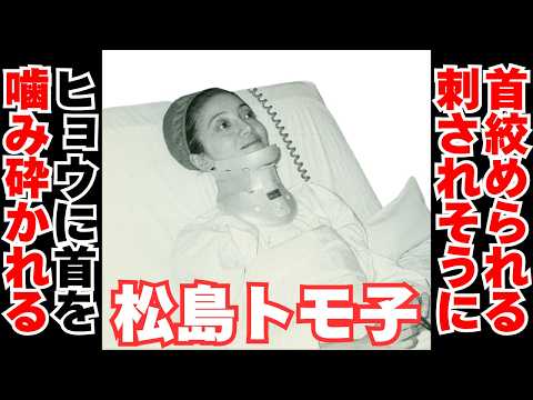 【衝撃】松島トモ子の人生が壮絶すぎる　ヒョウに首をかみ砕かれる サムネイル