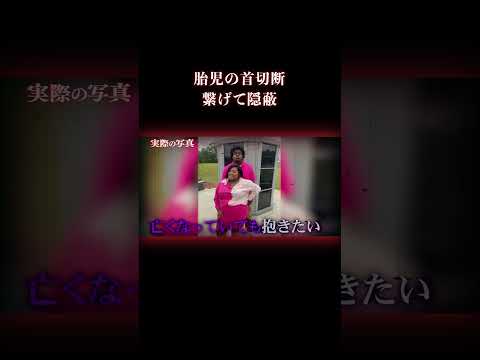 医師が頭を無理に引っ張り… 事件 海外事件