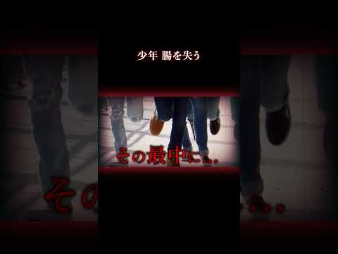 もう一生食事ができない… #事件 #怖い話 サムネイル