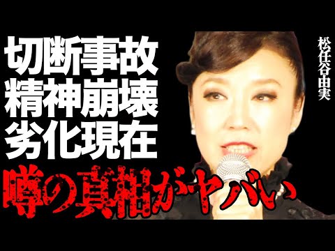 "ユーミン"こと松任谷由実が大事故で◯◯切断して精神崩壊した真相がヤバい…最愛の母の"死去"や老化による劣化現在にファ…
