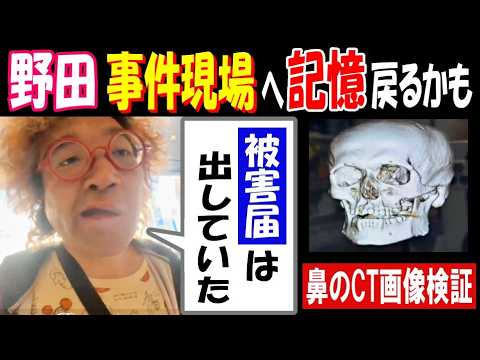 【野田】事件現場へ 記憶戻るかも「被害届は出していた」鼻のCT画像検証