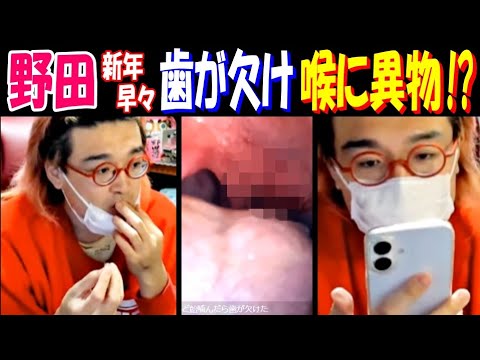 【野田】新年早々なのに歯が欠け、喉に異物!? サムネイル