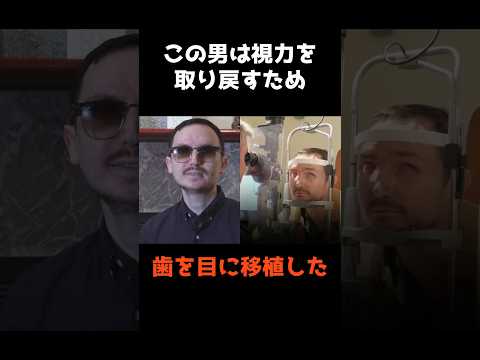 【視力を取り戻すために歯を目に移植した男】 #shorts #仰天 #雑学 サムネイル