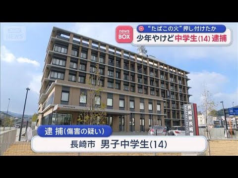 “たばこの火”押し付けたか 少年やけど　中学生（14）逮捕　長崎市【スーパーJチャンネル】(2026年5月26日)