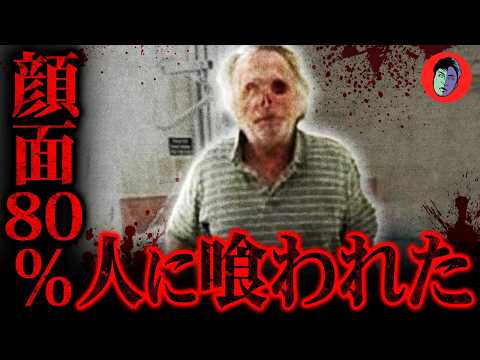 全裸でホームレスを喰らう…温厚な男が豹変した理由は…【マイアミゾンビ事件】 サムネイル