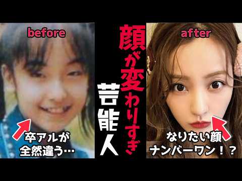 【ガルちゃん芸能】整形で顔が変わりすぎた女性芸能人【有益2ch】 サムネイル