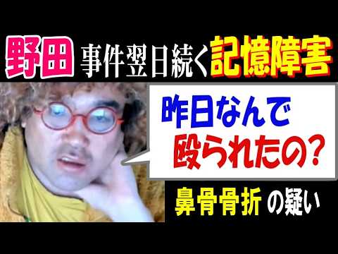 【野田】事件翌日続く記憶障害「昨日、なんで殴られたの?」鼻骨骨折の疑い サムネイル