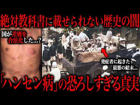 人類史上最も恐ろしい感染症をご存じですか？ サムネイル