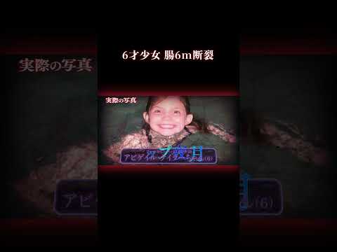 排水口にお尻を吸われ… 事件 プール サムネイル