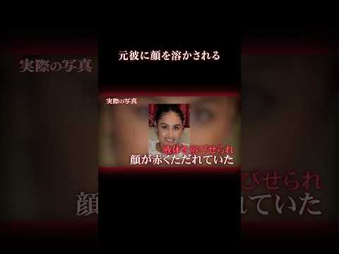 硫酸って怖い… 事件 海外事件 サムネイル