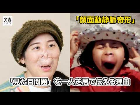 耳や口から出血、前歯を3本失い…鼻と上唇が変形して生まれた難病の女性（51）が一人芝居で伝えたいメッセージ