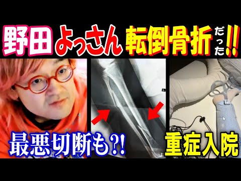 【野田】【よっさん】転倒骨折だった!! 最悪切断も?! 重症入院 サムネイル
