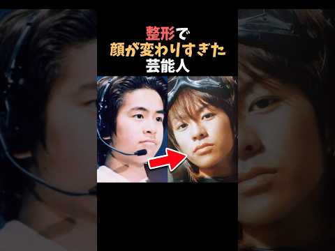【注目】整形で顔が変わりすぎた芸能人まとめPart2shorts 芸能人 芸能 サムネイル