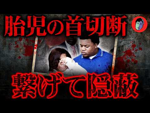 首元隠して「死産でした」と隠蔽…胎児の首を切断した医師