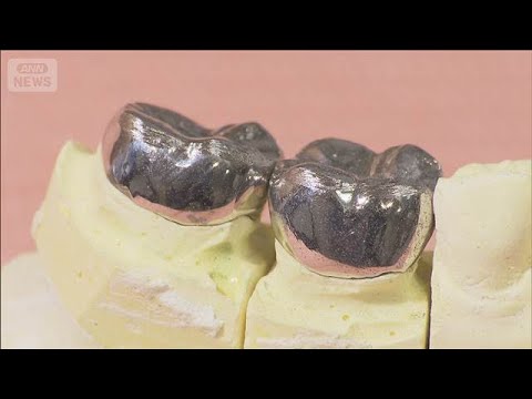 「銀歯治療するほど赤字」　貴金属高騰で歯医者ピンチ　1本あたり3000円自腹【グッド！モーニング】(2026年1月8日) サムネイル