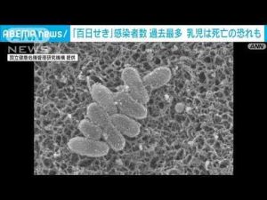 「百日せき」1週間の感染者578人で過去最多に　乳児感染で重症化も(2025年4月8日)ANNnewsCH